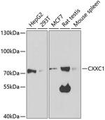 CGBP Antibody in Western Blot (WB)