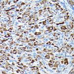 CYP11A1 Polyclonal Antibody