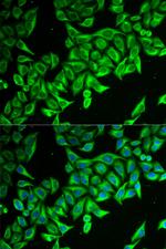 DAP Polyclonal Antibody