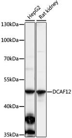 DCAF12 Polyclonal Antibody