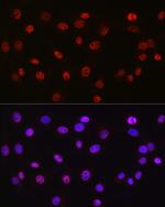 DDX39A Polyclonal Antibody