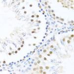 DDX46 Antibody in Immunohistochemistry (Paraffin) (IHC (P))