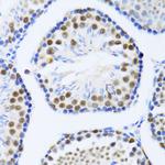 DDX46 Polyclonal Antibody