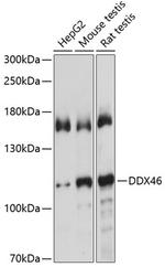 DDX46 Antibody in Western Blot (WB)