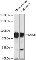 DGKB Antibody in Western Blot (WB)