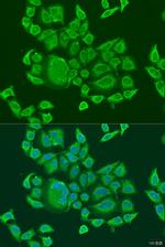 LGP2 Antibody in Immunocytochemistry (ICC/IF)