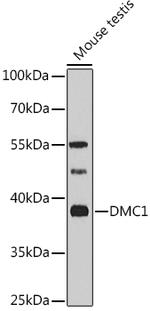 DMC1 Polyclonal Antibody