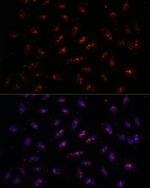TDIF2 Polyclonal Antibody