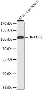 TDIF2 Antibody in Western Blot (WB)