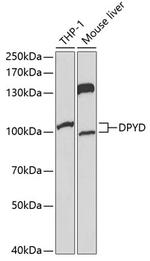 DPYD Polyclonal Antibody