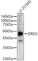 DRD2 Polyclonal Antibody