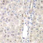 DTX2 Antibody in Immunohistochemistry (Paraffin) (IHC (P))