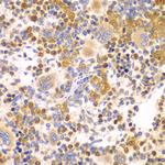 DTX2 Antibody in Immunohistochemistry (Paraffin) (IHC (P))