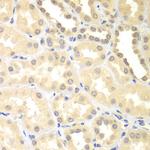 DTX2 Antibody in Immunohistochemistry (Paraffin) (IHC (P))