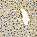 DTX2 Antibody in Immunohistochemistry (Paraffin) (IHC (P))