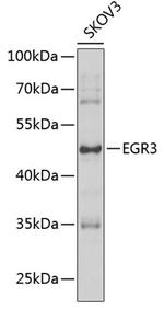 EGR3 Polyclonal Antibody