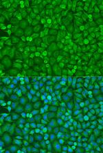 eIF4E Polyclonal Antibody
