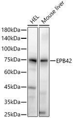 EPB42 Polyclonal Antibody