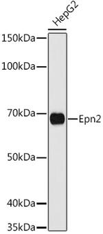 EPN2 Polyclonal Antibody
