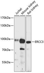 ERCC3 Polyclonal Antibody