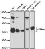 ERP44 Polyclonal Antibody