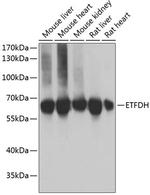 ETFDH Polyclonal Antibody