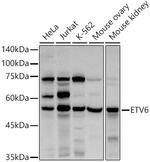 ETV6 Polyclonal Antibody