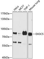 EXOC5 Polyclonal Antibody