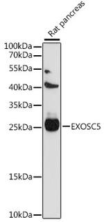 EXOSC5 Polyclonal Antibody