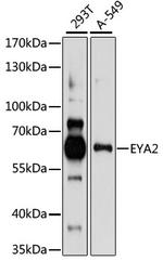EYA2 Polyclonal Antibody