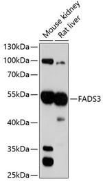 FADS3 Polyclonal Antibody