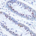 FAM3D Antibody in Immunohistochemistry (Paraffin) (IHC (P))