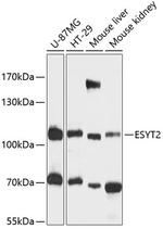 FAM62B Antibody in Western Blot (WB)