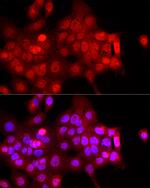 FBXW11 Antibody in Immunocytochemistry (ICC/IF)
