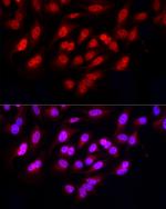 FBXW11 Antibody in Immunocytochemistry (ICC/IF)