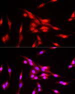 FBXW11 Polyclonal Antibody
