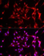 FBXW11 Antibody in Immunocytochemistry (ICC/IF)