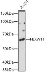 FBXW11 Antibody in Western Blot (WB)