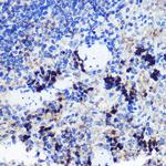 FCHSD1 Antibody in Immunohistochemistry (Paraffin) (IHC (P))