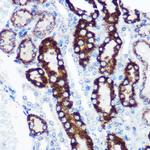 FCHSD1 Polyclonal Antibody