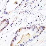FGF12 Polyclonal Antibody