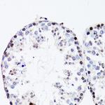 FGF12 Antibody in Immunohistochemistry (Paraffin) (IHC (P))