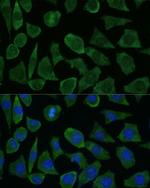 FKBP1B Polyclonal Antibody