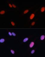 Fra2 Antibody in Immunocytochemistry (ICC/IF)