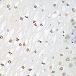 Fra2 Antibody in Immunohistochemistry (Paraffin) (IHC (P))