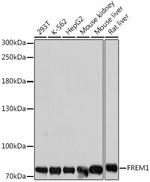 FREM1 Antibody in Western Blot (WB)