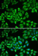 Ferritin Light Chain Antibody in Immunocytochemistry (ICC/IF)