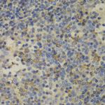 Ferritin Light Chain Antibody in Immunohistochemistry (Paraffin) (IHC (P))