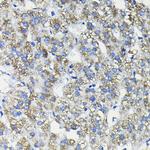 FUCA2 Polyclonal Antibody