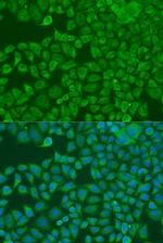 FXR2 Polyclonal Antibody